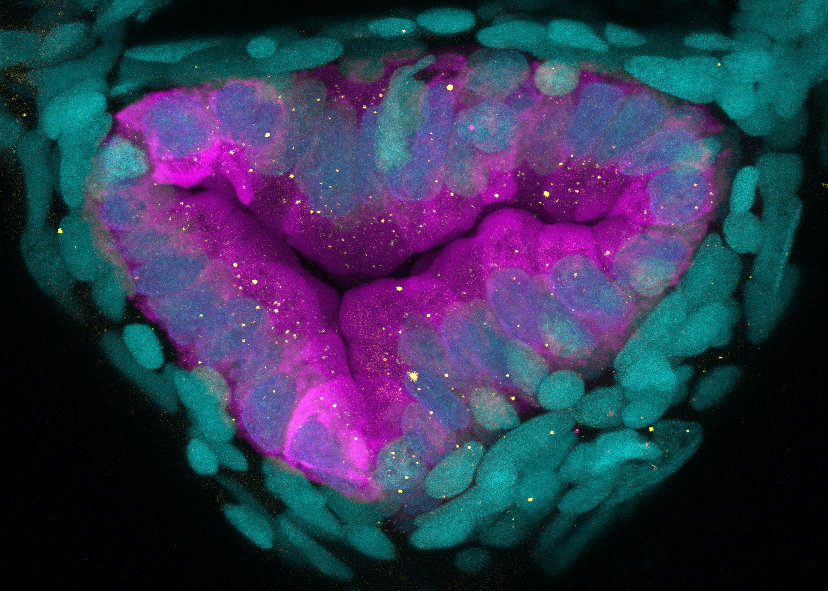  Ted Epsenschied – "The Inside Track." The image captures the cross section of the intestine from a transgenic zebrafish. Ted is a PhD student in Molecular Genetics and Microbiology in the Duke University School of Medicine.